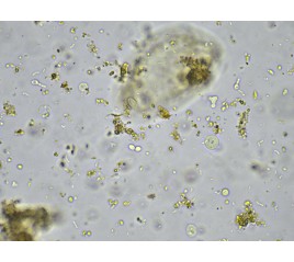 Blastocisti hominis a 40x