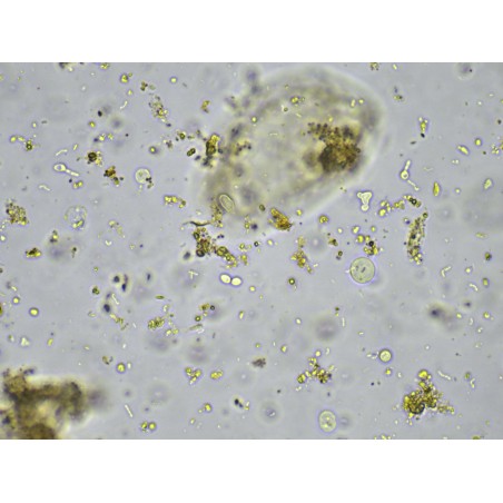 Blastocisti hominis a 40x