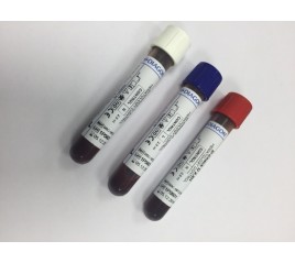 Controlli del sangue Diagon