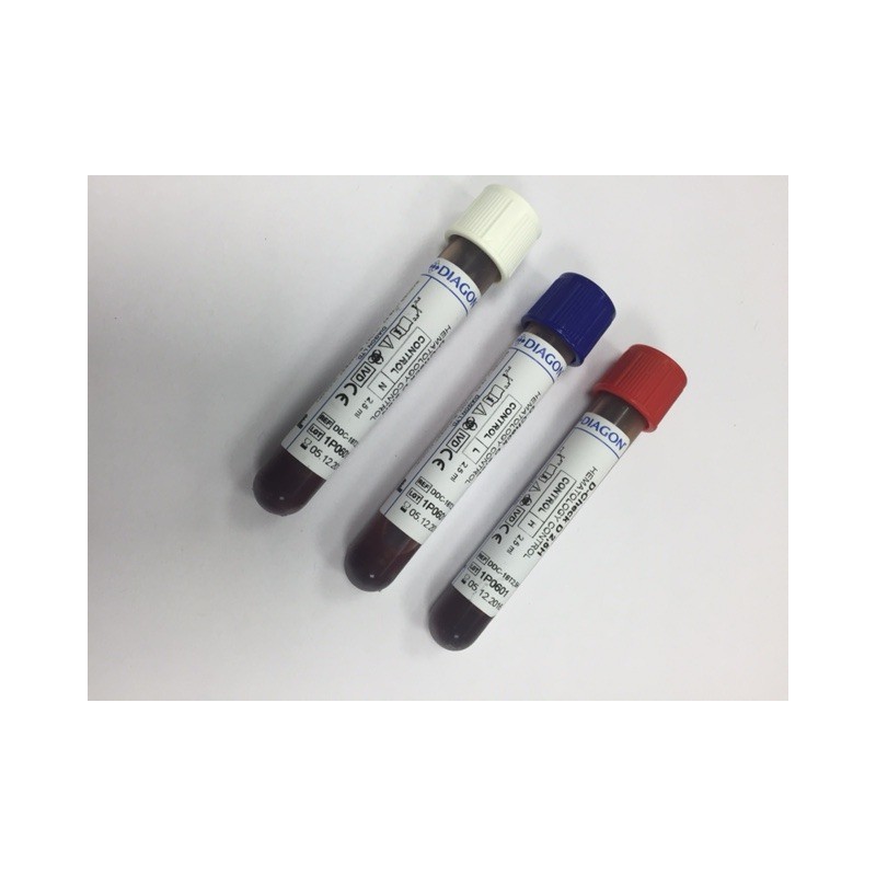 Controlli del sangue Diagon