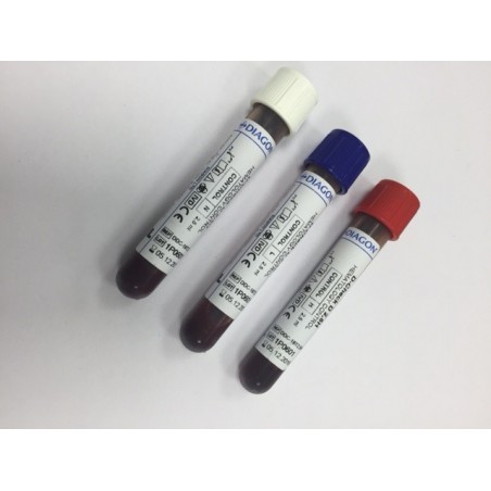 Controlli del sangue Diagon